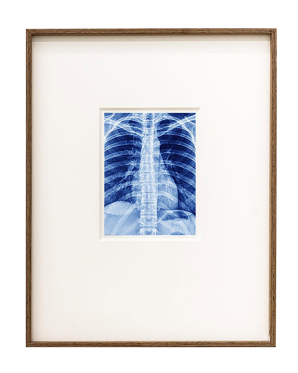 XRay